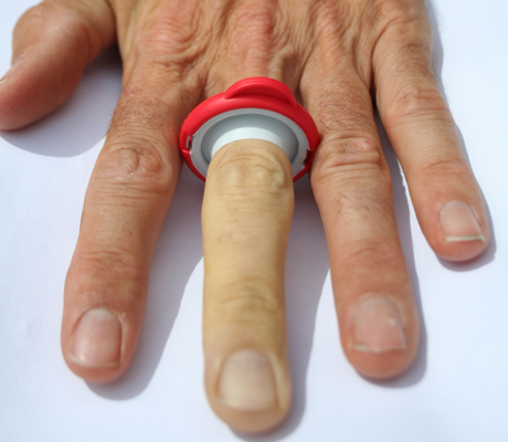 T-Ring device in place